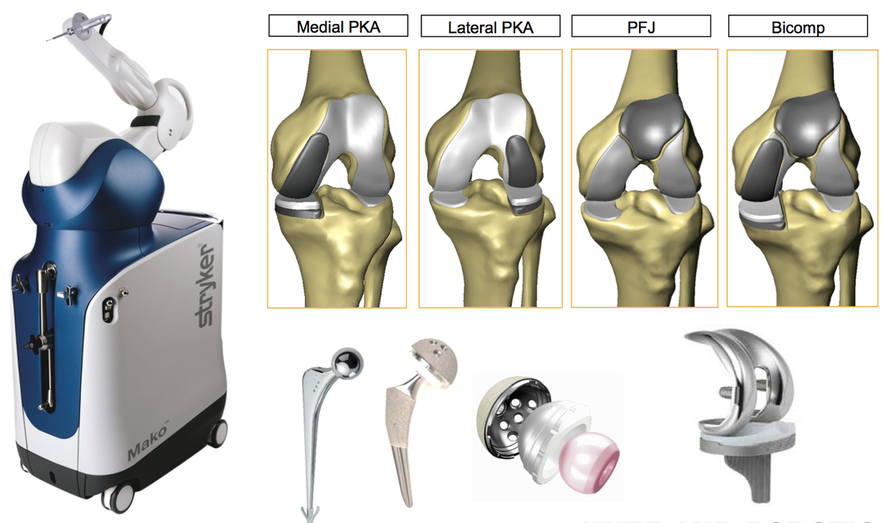 robotic-hip-knee-replacement-melbourne-shane-blackmore